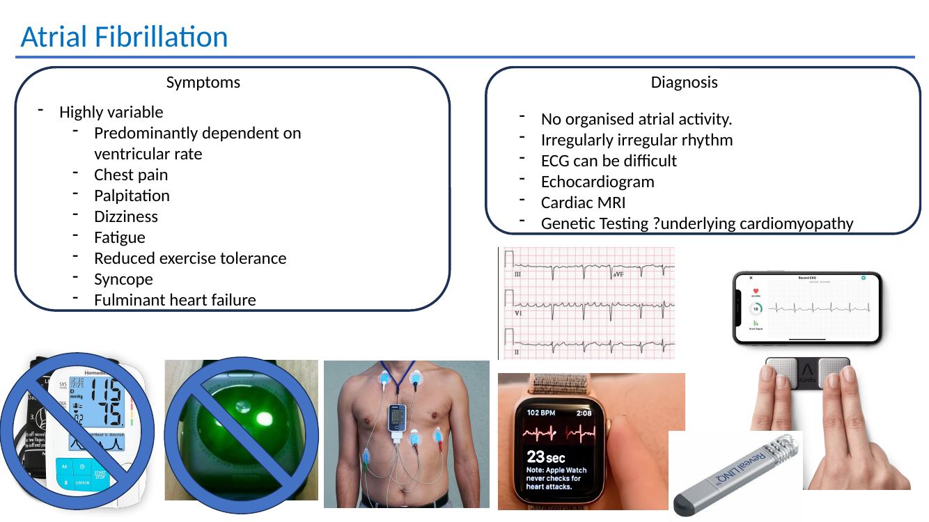 Atrial fibrillation symptoms and diagnosis