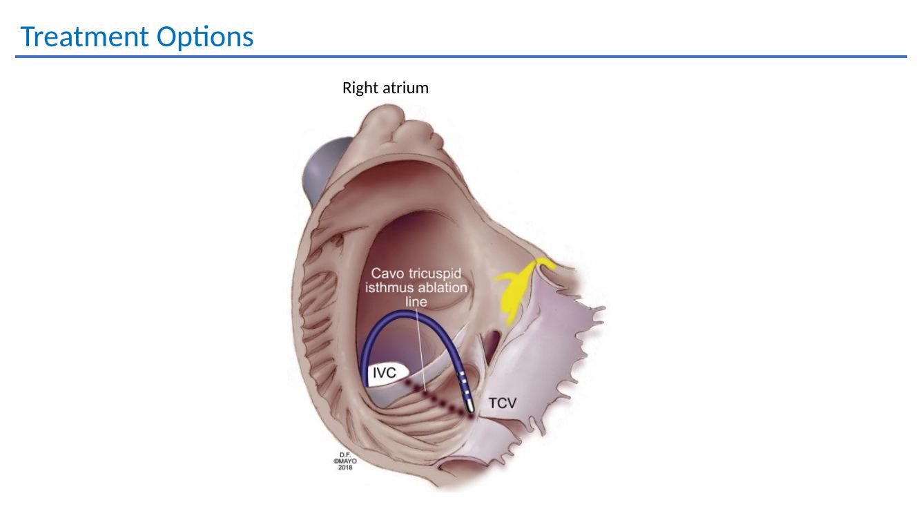 Atrial flutter ablation anatomy