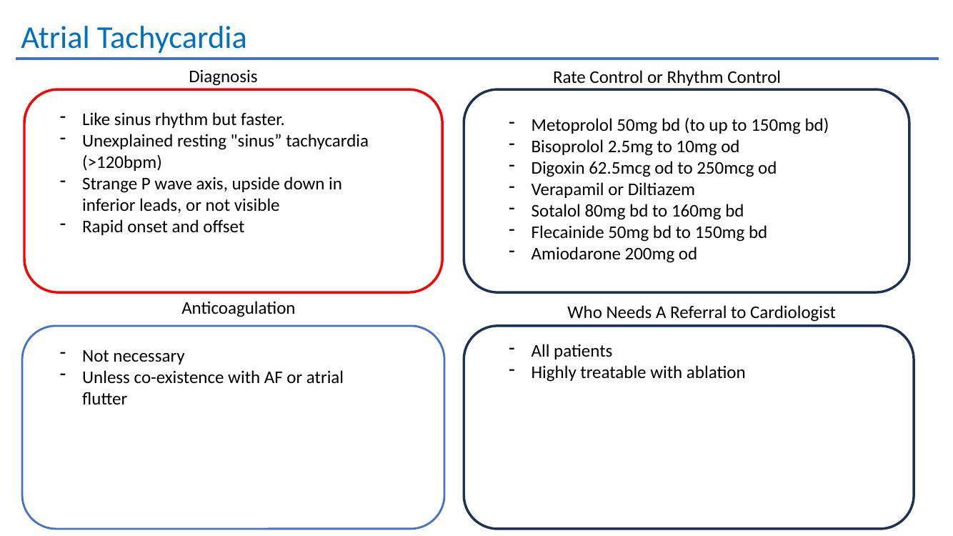 Atrial tachycardia slide