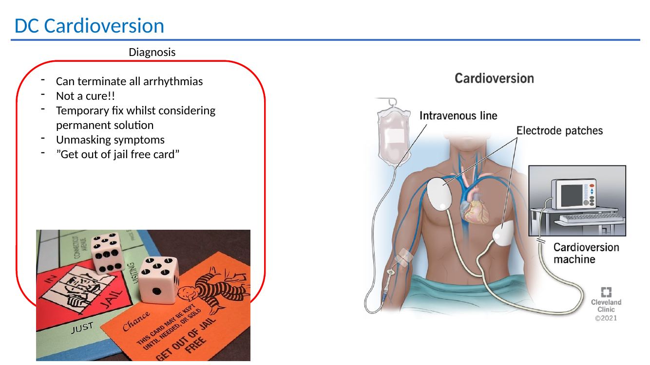 DC cardioversion