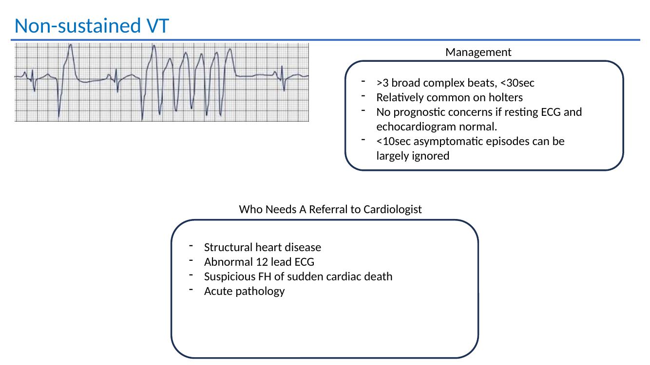 Non sustained ventricular tachycardia