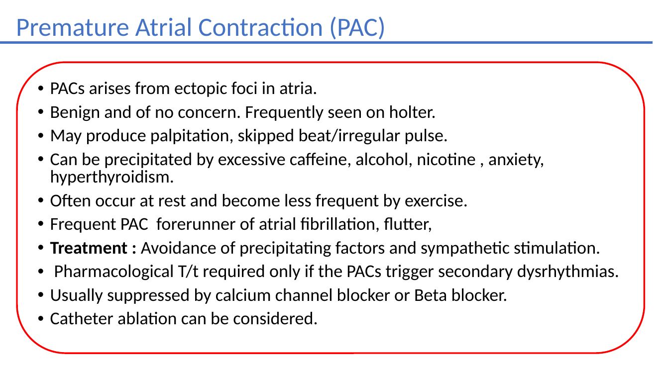 Premature atrial contractions management