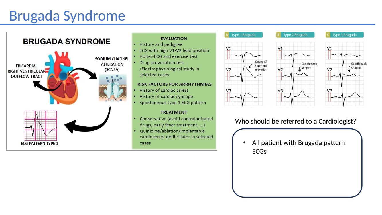 Brugada syndrome slide
